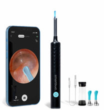 Load image into Gallery viewer, Smartbud™ Ear Cleaner